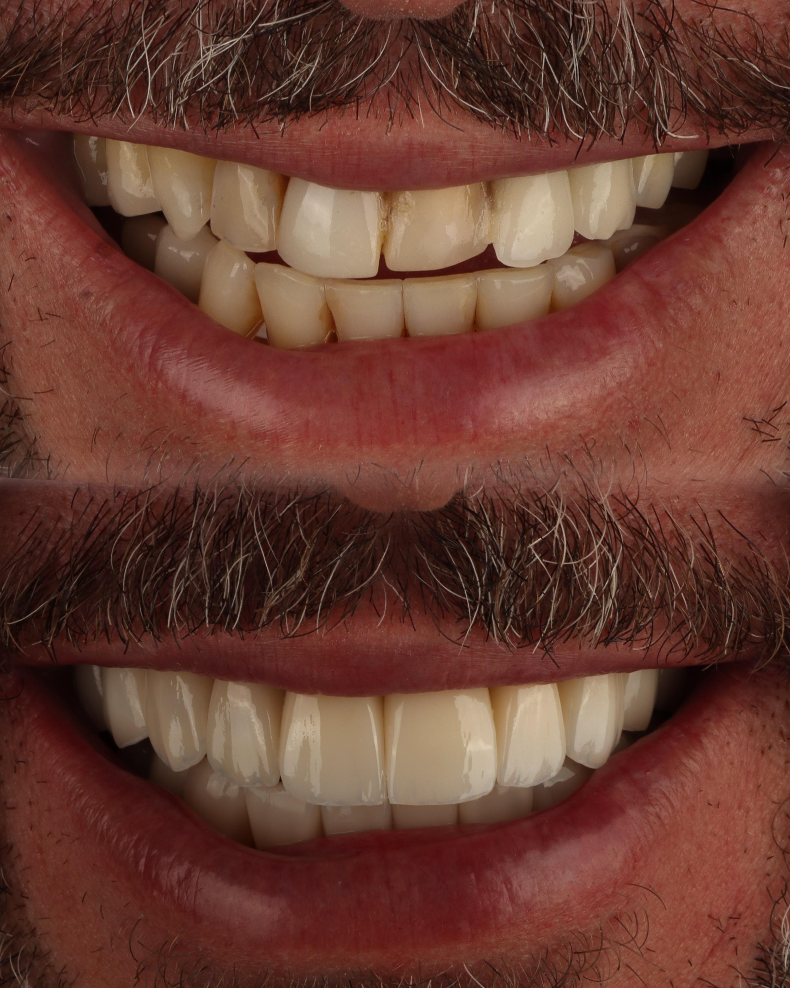 Antes e depois de tratamento estético