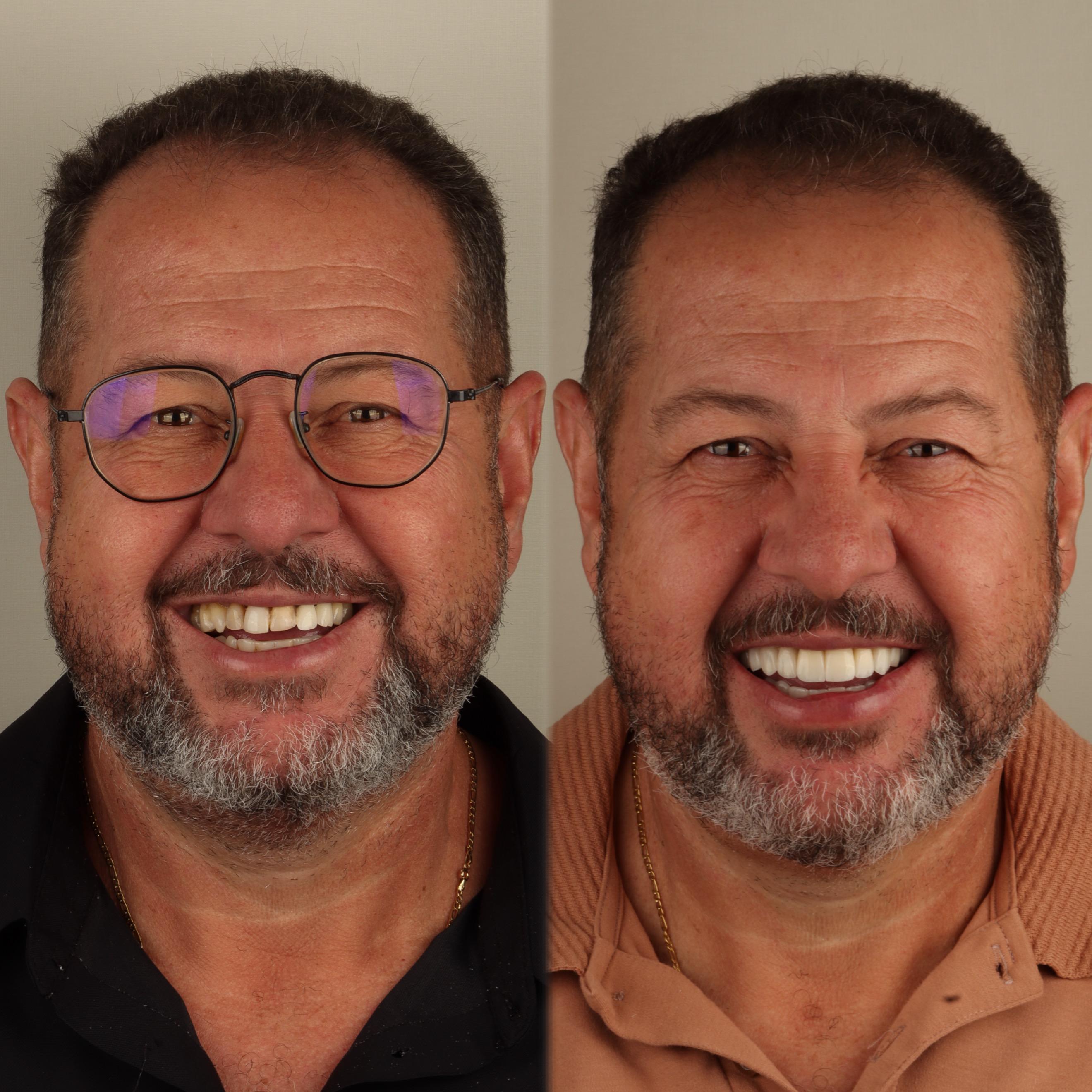 Paciente antes e depois do tratamento estético