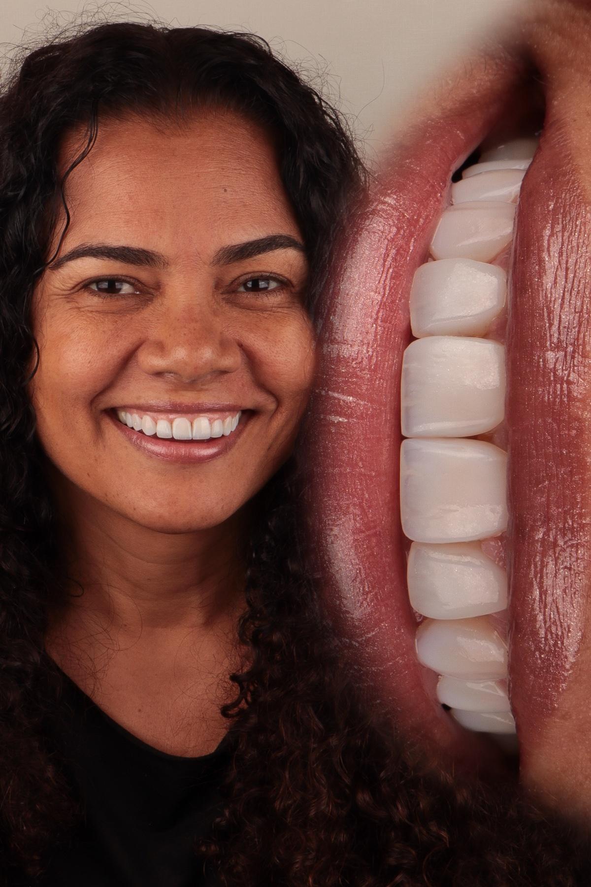 Paciente sorrindo após tratamento estético